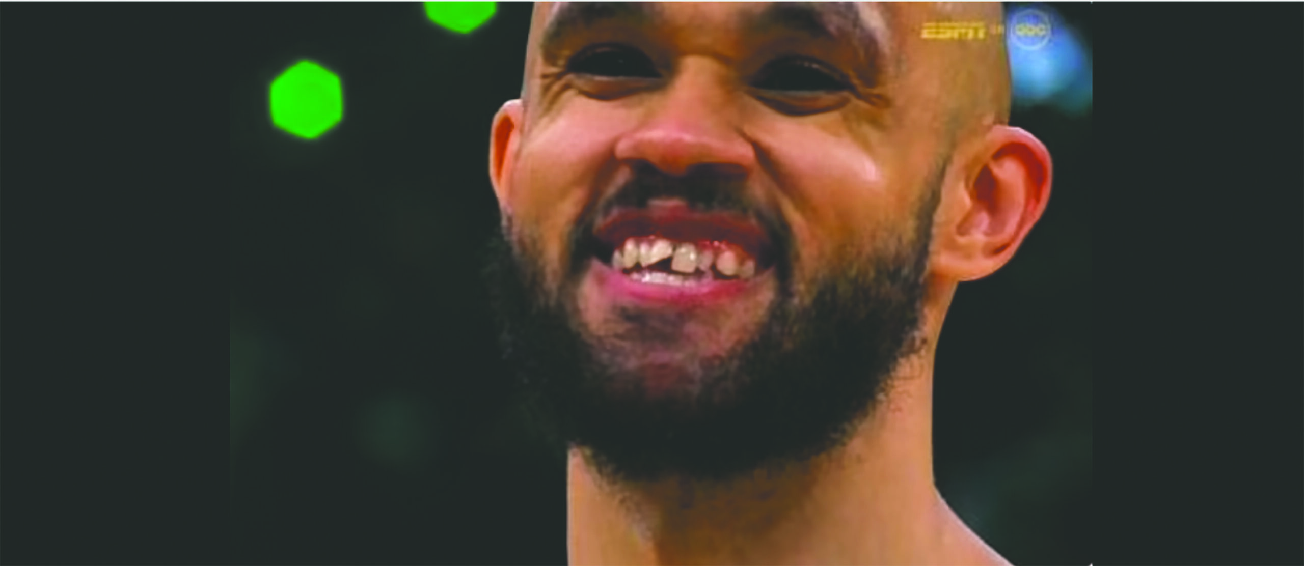 Basketball player who is missing some teeth